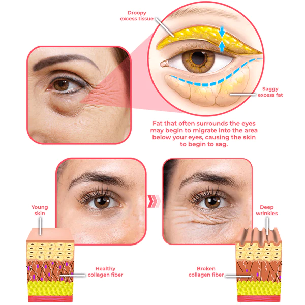 flysmus™ RadiantEyes Kollageen Lifting Eye Balm Stick