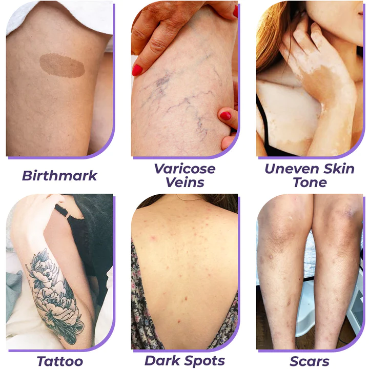 flysmus™ CoverPro Body Concealer