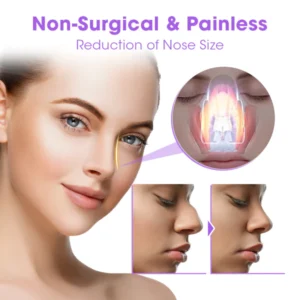 Alternative view of Biancat™ NosaNova Nose Sculpting Device