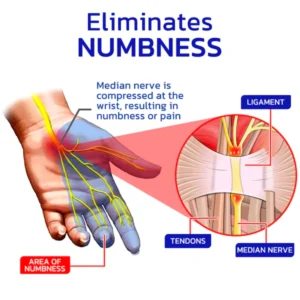 Alternative view of GFOUK™ NumbFix Hands and Foots Spray