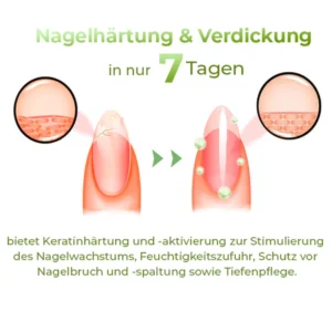 Alternative view of GFOUK™ PureCare Nagelbelebungsstifte