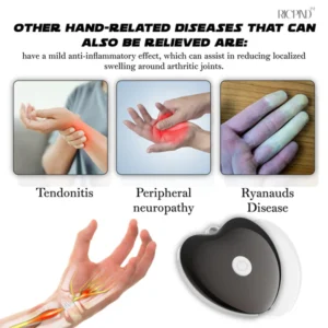 Alternative view of RICPIND NerveRelief Carpal Tunnel Therapy Device