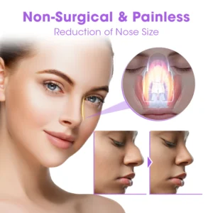 Alternative view of Wewersh® NosaNova Nose Sculpting Device