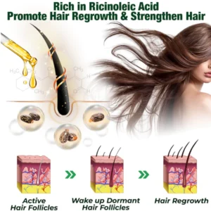 Alternative view of flysmus™ PureGrowth Jamaican Black Castor Oil