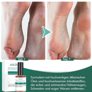 Alternative view of AEXZR™ Hühneraugenentfernung Extra Starkes Gel