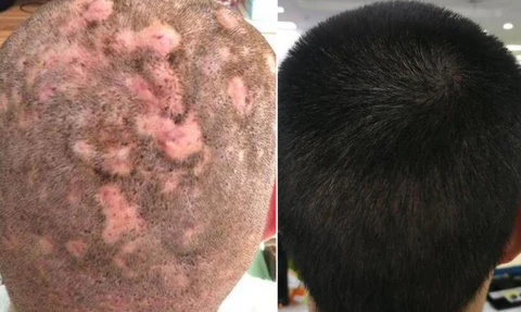 Awzlove™ Hair Follicle Repair Hair Growth Drops – Achieve thicker hair quickly
