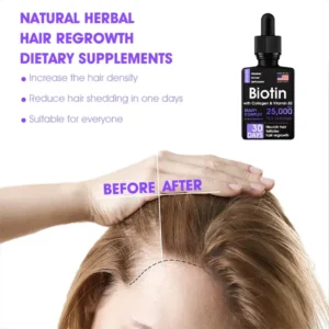Awzlove™ Hair Follicle Repair Hair Growth Drops – Achieve thicker hair quickly