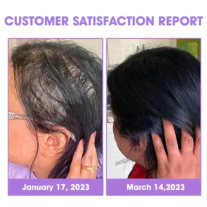 Awzlove™ Hair Follicle Repair Hair Growth Drops – Achieve thicker hair quickly