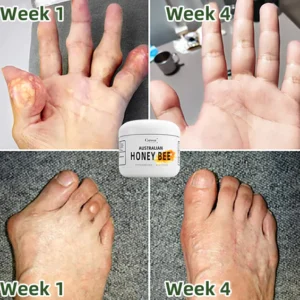Cvreoz™ Australian Bee Venom Pain and Bone Healing Balm