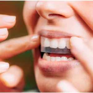 GFOUK™ Gum Repair Strips