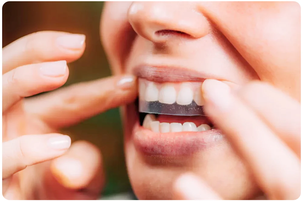 GFOUK™ Gum Repair Strips