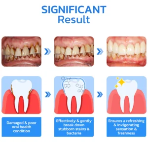 GFOUK™ Gum Repair Strips