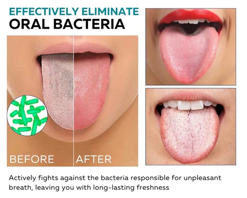 HealPlus™ Tongue Repair Spray