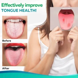 HealPlus™ Tongue Repair Spray
