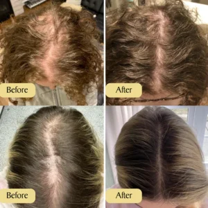 Alternative view of LIMETOW™ Natural Vegan Hair Growth Oil