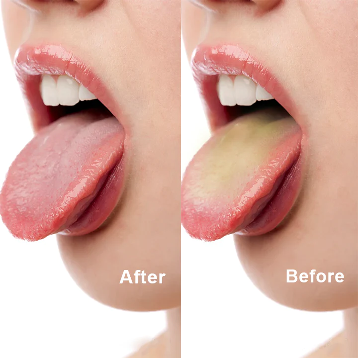 LIMETOW™ Tongue Cleaner - Image 7