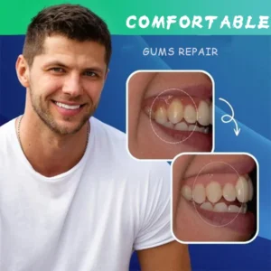 Alternative view of LIMETOW™Gum Repair Strips