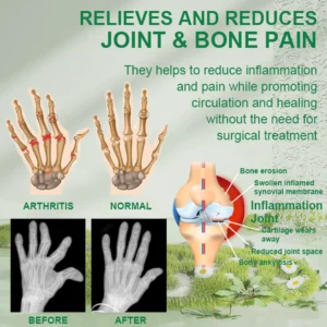Alternative view of LOVILDS™ Bee Venom Joint & Bone Therapy Cream