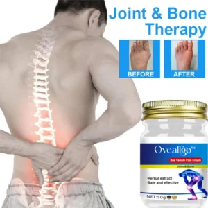 Alternative view of Oveallgo™ Bee Venom Joint & Bone Pain Healing Cream
