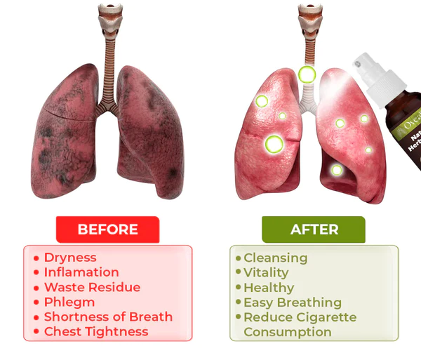 Oveallgo™ BreatheWell Natural Herbal Spray for Lung and Respiratory Support
