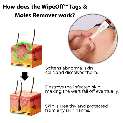 Oveallgo™ Nano-X WipeOff Tags & Moles Remover
