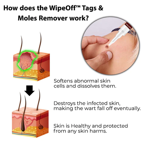Oveallgo™ Nano-X WipeOff Tags & Moles Remover