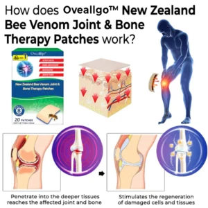Alternative view of Oveallgo™ New Zealand Bee Venom Joint & Bone Therapy Patches