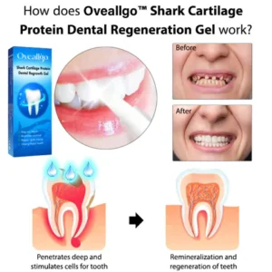 Alternative view of Oveallgo™ Shark Cartilage Protein Dental Regeneration Gel