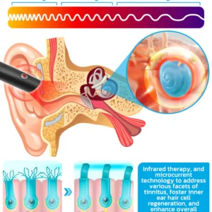 RICPIND Tinnitus NerveTreat InfraredThermal Pen