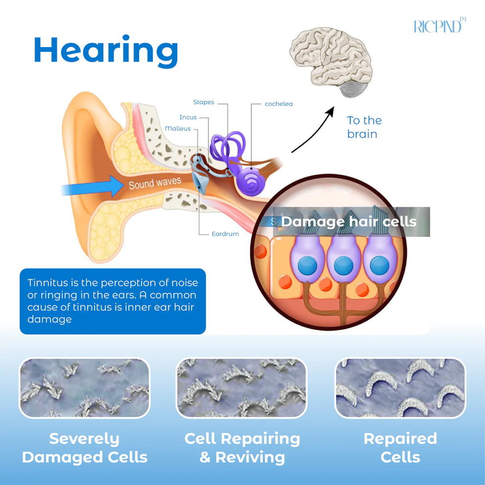 RICPIND Tinnitus NerveTreat InfraredThermal Pen