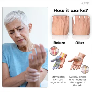 Alternative view of RICPIND Titanium Ionized Far Infrared Therapy ArthritisRelief Gloves