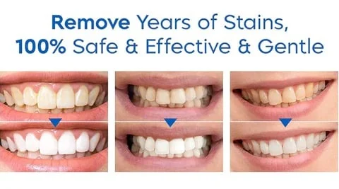 UNPREE™ Charcoal 24K Gold Whitening Toothpaste