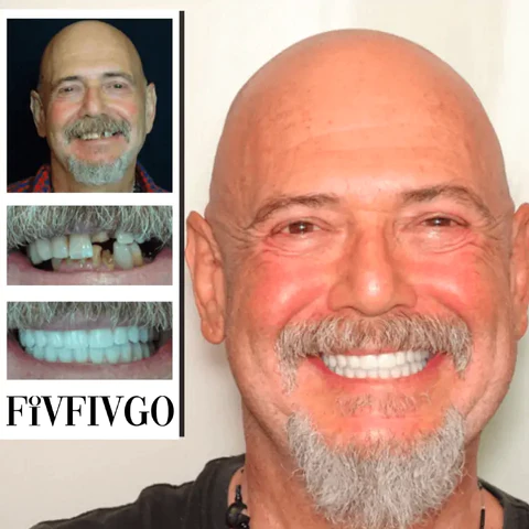 Fivfivgo™ Einstellbare Schnappprothese
