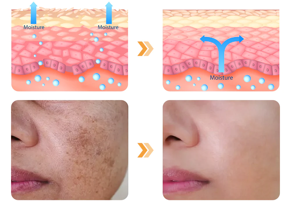 GFOUK™ FAFASKIN Back Spots And Acanthosis Nigricans Cleansing Lotion
