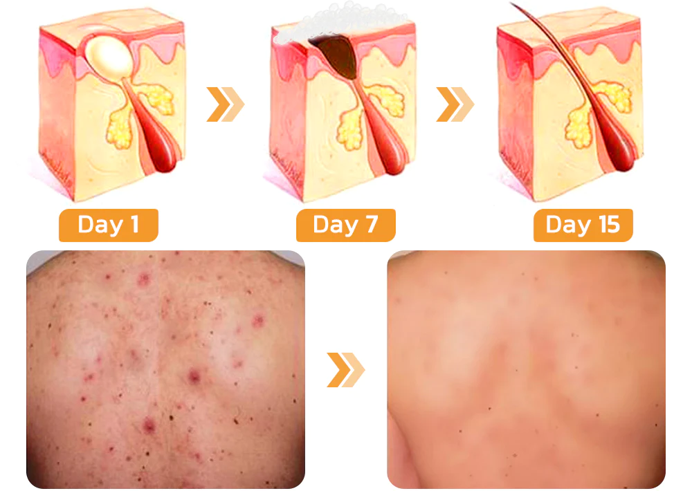 GFOUK™ FAFASKIN Back Spots And Acanthosis Nigricans Cleansing Lotion
