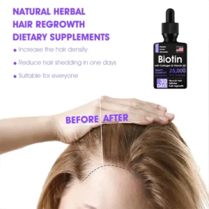 Oveallgo™ Super Nourishing Hair Follicle Repair Hair Growth Drops