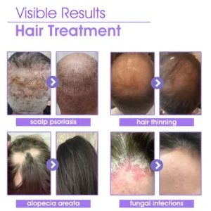 Oveallgo™ Super Nourishing Hair Follicle Repair Hair Growth Drops