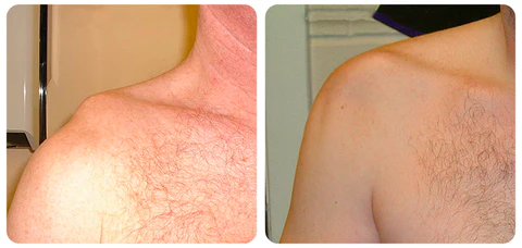 GFOUK™ ShoulderHeal Tourmaline Heating Compression Brace