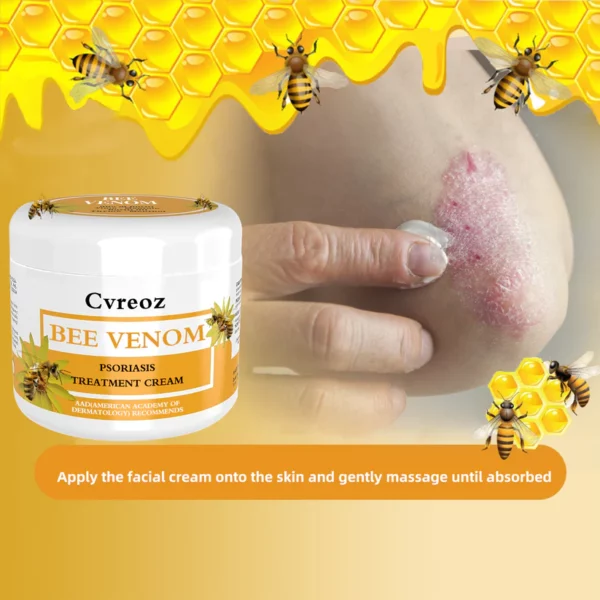 Ourlyard™ Multi-Simptom Psoriase Treatment Cream