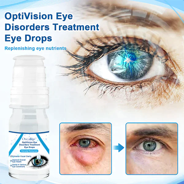 Oveallgo™ Clear OptiVision डोळा विकार उपचार आय ड्रॉप्स