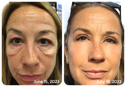 Oveallgo™ CELYN Crema para ojos tensa con péptidos