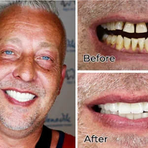 Fivfivgo™ FreshTooth360° Mundwasser