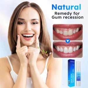 Fivfivgo™ Zahnfleischgel zur oralen Behandlung