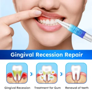 Fivfivgo™ Zahnfleischgel zur oralen Behandlung