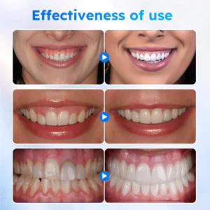 Fivfivgo™ Zahnfleischgel zur oralen Behandlung