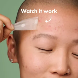 Seurico™ Overnight Hydrocolloid Acne Clear Patches