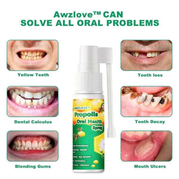 Awzlove™ Propolis Oral Health Spray