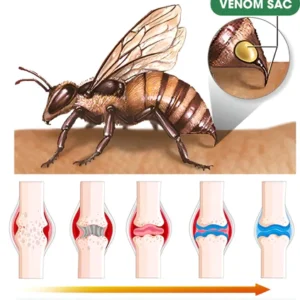 BeeZen™ New Zealand Bee Venom Sendi dan Krim Terapi Tulang Lanjutan