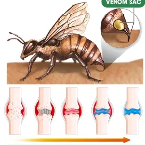 BeeZen™ New Zealand Bee Venom Joint and Bone Therapy Advanced Cream