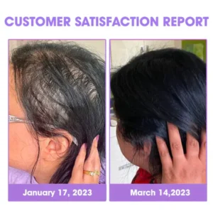 Fivfivgo™ Hair Follicle Repair Hair Growth Drops – Achieve thicker hair quickly